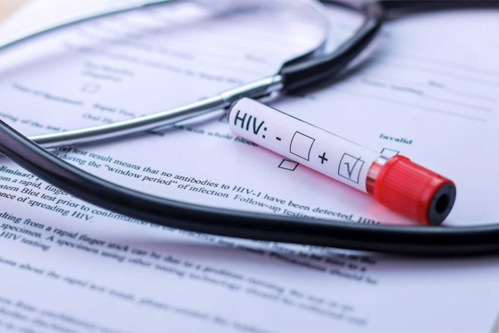 hiv virüsü nedir